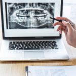 Why Do Dentists Do Radiographs?