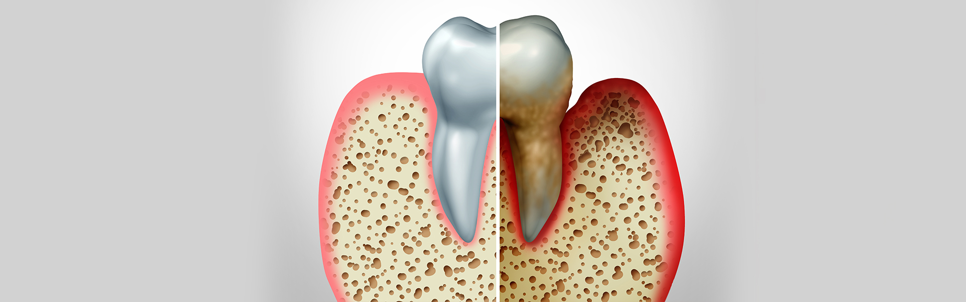 Can Decayed Teeth Affect Your Heart?